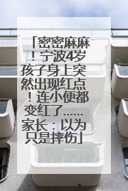 密密麻麻！宁波4岁孩子身上突然出现红点！连小便都变红了……家长：以为只是摔伤